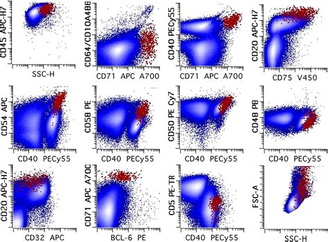 How Flow Cytometry Is Used To Diagnose and Monitor Lymphoma.